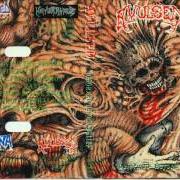 The lyrics ACHIEVING THE PERFECT DEFORMITY (INTRO) of AVULSED is also present in the album Deformed beyond belief (1993)