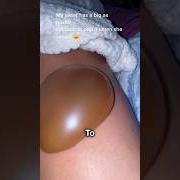 New bruises/stolen bikes ride faster - split