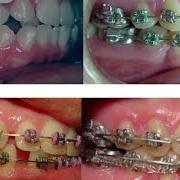 Diastema [ep]