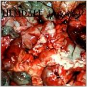 The lyrics DISSECTING THE CASEATED OMENTUM of EXHUMED is also present in the album In the name of gore (1996)